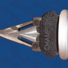 The Mini Spreader, view 3